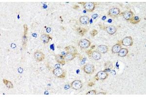 Immunohistochemistry of paraffin-embedded Rat brain using TSC2 Polyclonal Antibody at dilution of 1:200 (40x lens). (Tuberin anticorps)