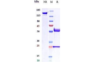 Anti-Amyloid Beta Reference Antibody (DLX212) on SDS-PAGE under reducing (R) condition. (Recombinant beta Amyloid anticorps)