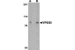 Western Blotting (WB) image for anti-Vacuolar Protein Sorting 53 Homolog (VPS53) (C-Term) antibody (ABIN1030797) (VPS53 anticorps  (C-Term))