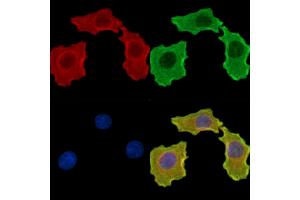 ABIN7095827 and ABIN7099889 staining HepG2 cells by IF/ICC. (ICEF1 anticorps)