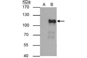 IP Image OCT1 antibody immunoprecipitates OCT1 protein in IP experiments. (POU2F1 anticorps)