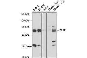 Western blot analysis of extracts of various cell lines, using BEST1 antibody (ABIN6127516, ABIN6137535, ABIN6137537 and ABIN6221403) at 1:1000 dilution. (Bestrophin 1 anticorps  (AA 376-585))