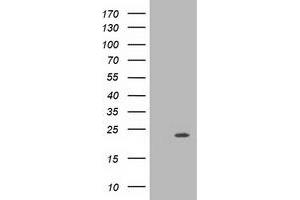 Western Blotting (WB) image for anti-Muscle RAS Oncogene Homolog (MRAS) antibody (ABIN1499553) (MRAS anticorps)