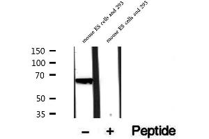 Western blot analysis of extracts of rat brain tissue, using PHF19 antibody.