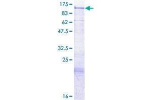 Image no. 1 for SH3-Domain GRB2-Like (Endophilin) Interacting Protein 1 (SGIP1) (AA 1-859) protein (GST tag) (ABIN1319812)