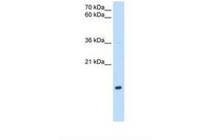 Image no. 1 for anti-NADH Dehydrogenase (Ubiquinone) 1 beta Subcomplex, 5, 16kDa (NDUFB5) (AA 69-118) antibody (ABIN6738155) (NDUFB5 anticorps  (AA 69-118))