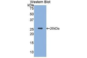 Western Blotting (WB) image for anti-Spectrin alpha Chain, Brain (SPTAN1) (AA 402-599) antibody (ABIN1172704) (SPTAN1 anticorps  (AA 402-599))