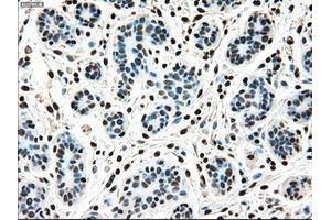 Immunohistochemical staining of paraffin-embedded breast tissue using anti-MAP2K4 mouse monoclonal antibody. (MAP2K4 anticorps)