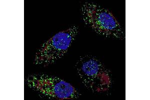 Fluorescent image of  cells stained with cleaved LC3B antibody. (LC3B anticorps  (cleaved))