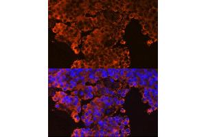 Immunofluorescence analysis of rat pituitary gland cells using GHRHR Rabbit pAb (ABIN6127953, ABIN6141077, ABIN6141078 and ABIN6224478) at dilution of 1:100 (40x lens).