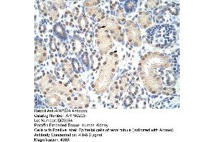 Rabbit Anti-ANP32A Antibody  Paraffin Embedded Tissue: Human Kidney Cellular Data: Epithelial cells of renal tubule Antibody Concentration: 4. (PHAP1 anticorps  (Middle Region))