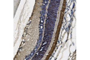 IHC analysis of PDE6 beta/PDE6B using anti-PDE6 beta/PDE6B antibody (ABIN7600893). (PDE6B anticorps  (AA 25-237))