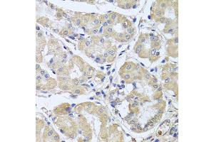 Immunohistochemistry of paraffin-embedded human gastric using CEP57L1 antibody at dilution of 1:100 (x40 lens).