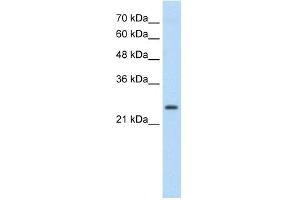 TSHR antibody used at 0. (TSH receptor anticorps  (C-Term))