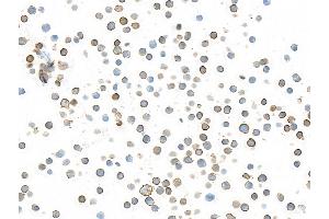 Immunocytochemistry (ICC) image for anti-CD226 (CD226) (AA 19-229) antibody (ABIN7455092)