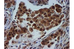 Image no. 5 for anti-Metalloproteinase Inhibitor 2 (TIMP2) antibody (ABIN1501393) (TIMP2 anticorps)