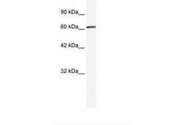 ZMYM6 antibody  (AA 625-674)