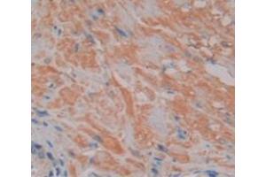 IHC-P analysis of Human Tissue, with DAB staining. (NFAT1 anticorps  (AA 392-574))