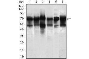 Western blot analysis using WHSC2 mouse mAb against Jurkat (1), HeLa (2), HEK293 (3), A549 (5), SPC-A-1 (6) cell lysate, and Rat brain (4) tissue lysate.