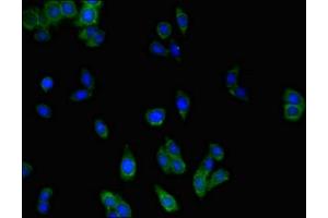 Immunofluorescent analysis of HepG2 cells using ABIN7159344 at dilution of 1:100 and Alexa Fluor 488-congugated AffiniPure Goat Anti-Rabbit IgG(H+L) (MLC1 anticorps  (AA 1-49))
