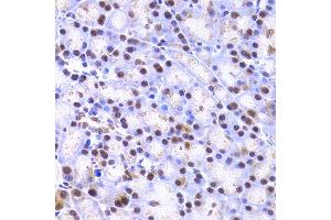 Immunohistochemistry of paraffin-embedded rat pancreas using XRCC4 antibody at dilution of 1:200 (400x lens). (XRCC4 anticorps)
