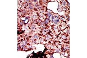 Image no. 1 for anti-Hexokinase 1 (HK1) (C-Term) antibody (ABIN360645)