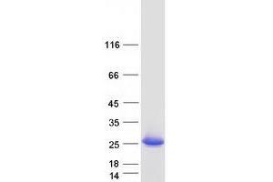 DCMP Deaminase (DCTD) (Transcript Variant 1) protein (Myc-DYKDDDDK Tag)