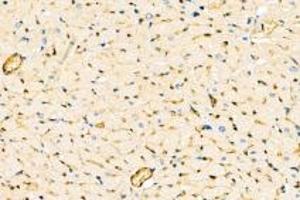Immunohistochemistry analysis of paraffin-embedded rat heart using,DMPK (ABIN7073790) at dilution of 1: 2000