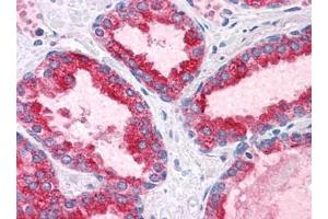 Human Prostate: Formalin-Fixed, Paraffin-Embedded (FFPE) (BCAS1 anticorps  (C-Term))