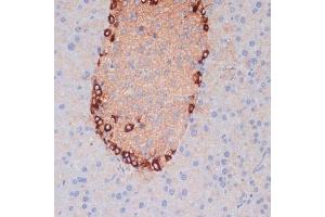 Immunohistochemistry of paraffin-embedded mouse pancreas using  antibody (ABIN6131192, ABIN6137264, ABIN6137265 and ABIN6215207) at dilution of 1:100 (40x lens). (ATG5 anticorps  (AA 28-275))