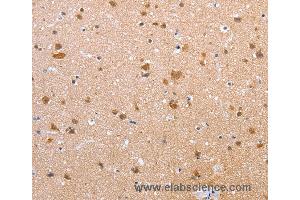 Immunohistochemistry of Human brain using CLDN10 Polyclonal Antibody at dilution of 1:50 (CLDN10 anticorps)