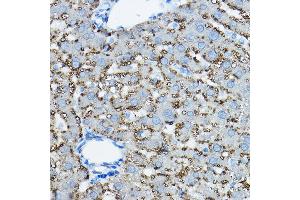 Immunohistochemistry of paraffin-embedded rat liver using Perilipin-2 Rabbit pAb (ABIN6127414, ABIN6145773, ABIN6145774 and ABIN6221871) at dilution of 1:50 (40x lens).