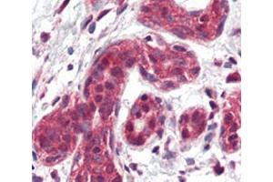 IHC analysis of FFPE human breast tissue stained with SLUG antibody.