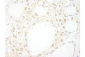 Immunohistochemistry (IHC) image for anti-WD Repeat Domain 20 (WDR20) (AA 450-500) antibody (ABIN7448862) (WDR20 anticorps  (AA 450-500))