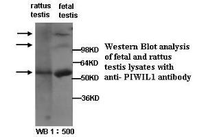 Image no. 1 for anti-Piwi-Like 1 (PIWIL1) (Internal Region) antibody (ABIN790869) (PIWIL1 anticorps  (Internal Region))