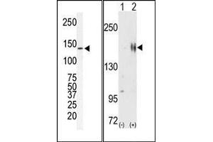(LEFT)Western blot analysis of anti-ErbB2 Pab in SKBR-3 cell lysate. (ErbB2/Her2 anticorps  (N-Term))