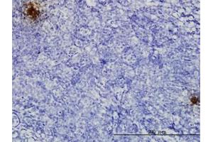 Image no. 3 for anti-Tissue Factor Pathway Inhibitor 2 (TFPI2) (AA 1-236) antibody (ABIN599020) (TFPI2 anticorps  (AA 1-236))