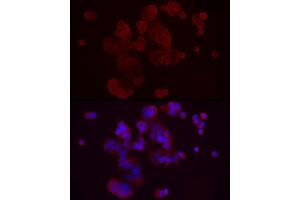 Immunofluorescence analysis of MCF7 cells using DKK3 Rabbit pAb (ABIN3016192, ABIN3016193, ABIN3016194, ABIN1679536 and ABIN6219615) at dilution of 1:50 (40x lens).