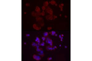 Immunofluorescence analysis of MCF7 cells using DKK3 Rabbit pAb (ABIN3016192, ABIN3016193, ABIN3016194, ABIN1679536 and ABIN6219615) at dilution of 1:50 (40x lens). (DKK3 anticorps  (AA 22-350))