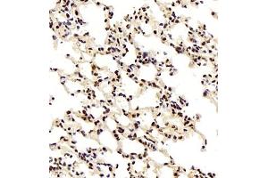 Immunohistochemistry of paraffin embedded mouse lung using smad62024 (ABIN7075629) at dilution of 1:1000 (400x lens)