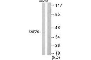 Western blot analysis of extracts from HuvEc cells, using ZNF75 Antibody. (ZNF75 anticorps  (AA 296-345))