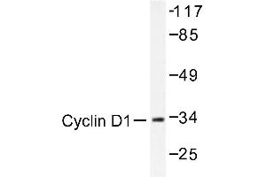 Image no. 1 for anti-Cyclin D1 (CCND1) antibody (ABIN272112) (Cyclin D1 anticorps)
