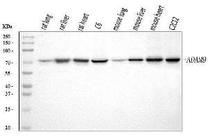 Western blot analysis of ADAM9 using anti-ADAM9 antibody (ABIN7601124).