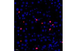 Immunofluorescence of paraffin embedded rat liver using PTPN2 (ABIN7075295) at dilution of 1:500 (400x lens)