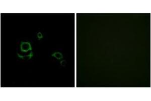 Immunofluorescence analysis of HuvEc cells, using F13B Antibody.