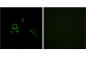 Immunofluorescence analysis of HuvEc cells, using F13B Antibody. (F13B anticorps  (AA 61-110))