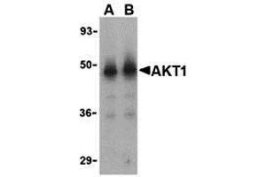 Western Blotting (WB) image for anti-V-Akt Murine Thymoma Viral Oncogene Homolog 1 (AKT1) (N-Term) antibody (ABIN1031225) (AKT1 anticorps  (N-Term))