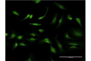 Immunofluorescence of monoclonal antibody to ID1 on HeLa cell.
