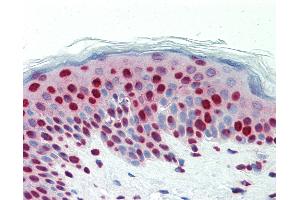 Anti-DCLRE1C / Artemis antibody IHC staining of human skin.