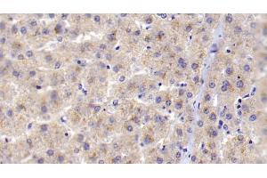 Detection of C1qB in Human Liver Tissue using Polyclonal Antibody to Complement Component 1, Q Subcomponent B (C1qB) (C1QB anticorps  (AA 28-253))